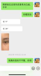 -南京健丽·去眼袋医疗美容机构