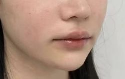 -Yestar重庆艺星医疗美容医院