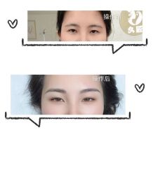 -久匠半永久纹眉