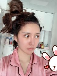 点击看大图 -大麦微针植发丨全国连锁