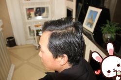 点击看大图 -大麦微针植发丨全国连锁