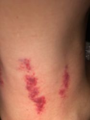 -社区十元理疗养生馆