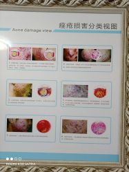 -蕾特恩·专业祛痘国际连锁