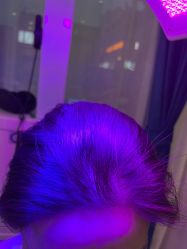 -雍禾植发全国连锁