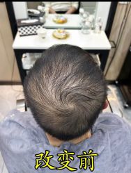 -唐风采假发补发定制