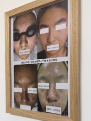 -美肤盾祛痘·问题肌头疗管理中心