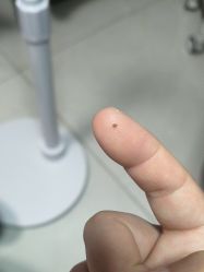 -北京美痣堂古方祛痣斑疣瘊