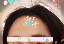 -大麦微针植发全国连锁