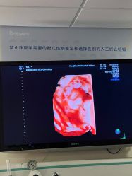 -杭州贝瑞斯美华妇儿医院·早孕·产检·儿科