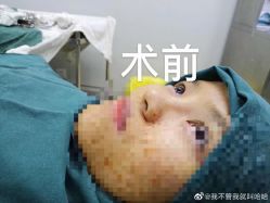 点击看大图 -弘美医美·艾维岚童颜抗衰中心