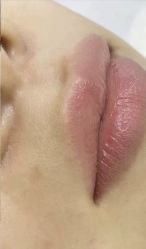 -素美医疗美容·西南眼鼻整形·修复基地