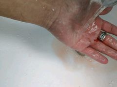 -首都医科大学附属北京潞河医院