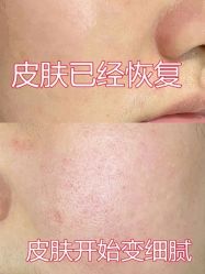 -长沙雅美医疗美容医院