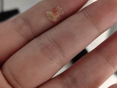 -新甲连锁灰指甲·甲沟炎·鸡眼(黑龙江路店)