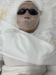 -凡碧诗毛孔清洁收细