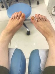 -派恩宜灰指甲鸡眼嵌甲手足癣