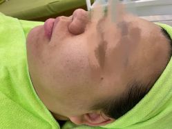 -苗医生草本科技祛痘