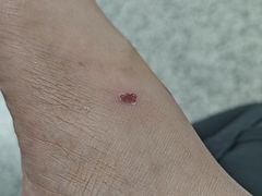 -大连市皮肤病医院