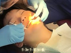 -华西牙科·四川口腔医院