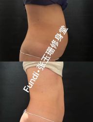 -Fundi张玉珊修身堂·indiba·BTL科技瘦身