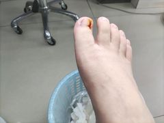 -世龙世家甲沟炎·灰指甲·嵌甲矫正·修脚(武侯区双楠店)