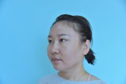 体验前-Yestar艺星整形美容医院
