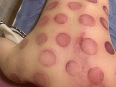 -沈师傅盲人按摩工作室(密三小区店)