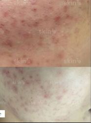 -SKIN79皮肤管理中心