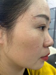 -长沙雅美医疗美容医院