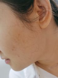 -广州美莱医疗美容医院