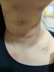 -北京美痣堂古方祛痣斑疣瘊