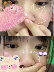 体验前-容丽妍医疗美容