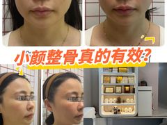 -修申骨雕小颜脊柱骨盆管理产后修复