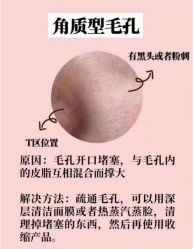 -美肤盾祛痘·问题肌头疗管理中心