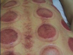 -益友堂盲人推拿正骨穴位按摩工作室