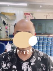 -极客侠男士假发定制补发