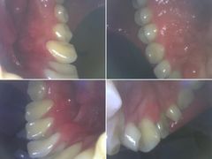 -同步齿科·数字化正畸种植口腔中心(前山店)