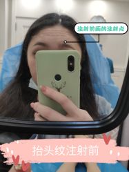 -伊丽莎白医疗美容