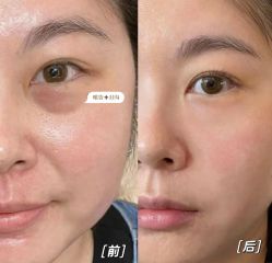 -天津健丽·去眼袋医疗美容机构