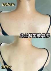 -Boss H Beauty美肌中心