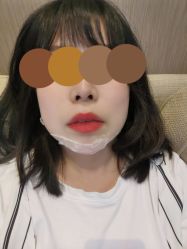 体验前-四川娇点医学美容医院