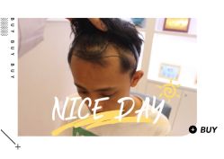 -大麦微针植发全国连锁