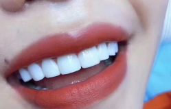 点击看大图 -美朵纹绣美牙纹眉工作室