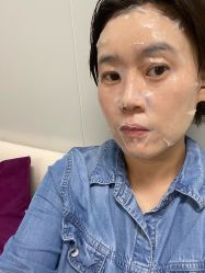 体验后-叶美人医疗美容
