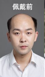 -发饰美男士增发补发假发定制店