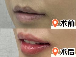 -深圳艺星医疗美容医院