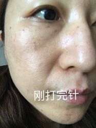 体验前-天津伊美尔医疗整形美容专科医院