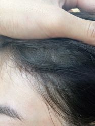 -熙朵美学植发连锁