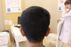 -大麦微针植发丨全国连锁