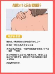 -美肤盾祛痘·问题肌头疗管理中心